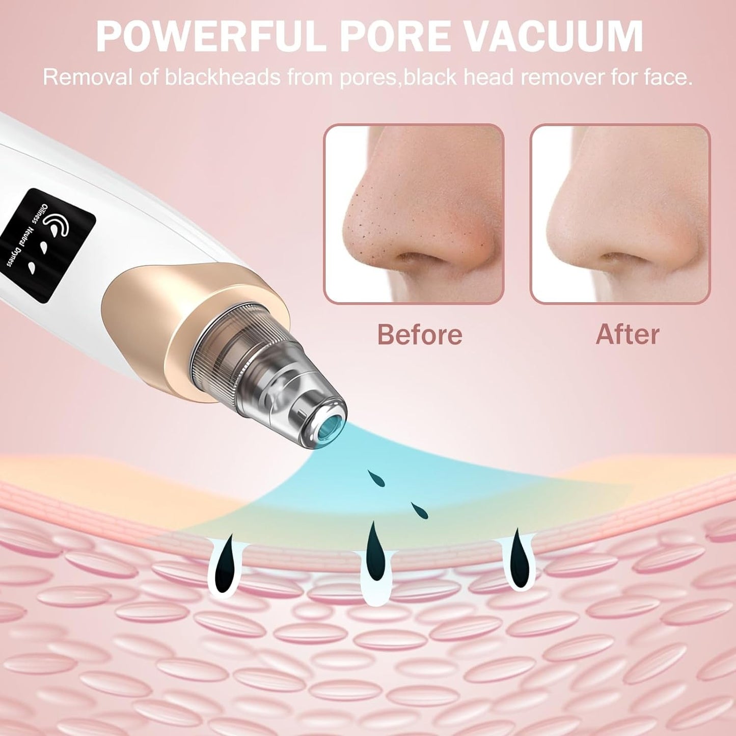 LED Blackhead Remover Vacuum